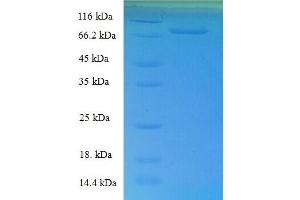 SDS-PAGE (SDS) image for Docking Protein 1, 62kDa (Downstream of tyrosine Kinase 1) (DOK1) (AA 1-481), (full length) protein (His-SUMO Tag) (ABIN5711727) (DOK1 Protein (AA 1-481, full length) (His-SUMO Tag))