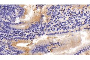 Detection of MPIF2 in Mouse Small intestine Tissue using Polyclonal Antibody to Myeloid Progenitor Inhibitory Factor 2 (MPIF2) (CCL24 antibody  (AA 27-119))