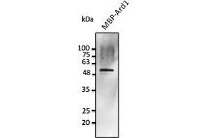 Western Blotting (WB) image for anti-Protein Phosphatase 1, Regulatory Subunit 8 (PPP1R8) antibody (ABIN7272976) (PPP1R8 antibody)