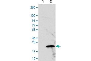 Western blot analysis of Lane 1: Negative control (vector only transfected HEK293T lysate). (PRELID2 antibody)