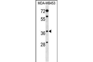 Western blot analysis in MDA-MB453 cell line lysates (35ug/lane). (PAQR8 antibody  (C-Term))