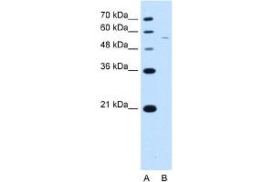 WB Suggested Antibody Titration:  2. (RSRC2 antibody  (C-Term))