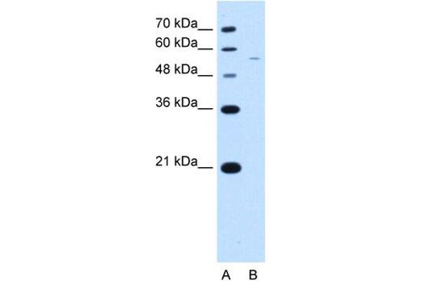 RSRC2 antibody  (C-Term)