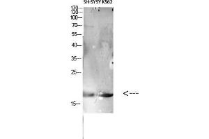 Western Blot (WB) analysis of specific cells using Antibody diluted at 1:1000.