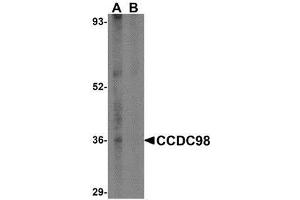Western blot analysis of CCDC98 in human breast tissue lysate in (A) the absence and (B) presence of blocking peptide with AP30214PU-N CCDC98 antibody at 1 μg/ml.