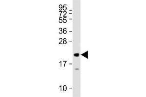 MML2 antibody tested on human recombinant protein at 1:27000.