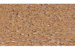 Detection of H-FABP in Rat Cardiac Muscle Tissue using Polyclonal Antibody to Heart-type Fatty Acid Binding Protein (H-FABP)