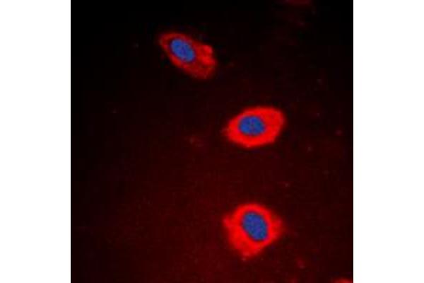 NT5C1B anticorps  (Center)