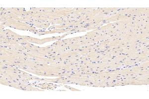 Detection of LEP in Mouse Cardiac Muscle Tissue using Polyclonal Antibody to Leptin (LEP) (Leptin antibody  (AA 22-167))