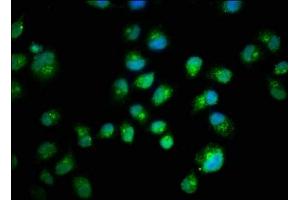 Immunofluorescence (IF) image for anti-SMAD, Mothers Against DPP Homolog 2 (SMAD2) (AA 2-467) antibody (ABIN7160228)