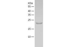 Western Blotting (WB) image for TATA-Binding Protein-Associated Phosphoprotein (DR1) (AA 1-176) protein (His tag) (ABIN7286917) (DR1 Protein (AA 1-176) (His tag))