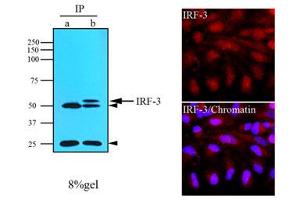 Western Blotting (WB) image for anti-Interferon Regulatory Factor 3 (IRF3) (AA 108-166) antibody (ABIN317099)