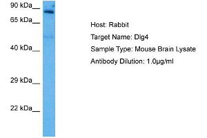 Host: Rabbit Target Name: DLG4 Sample Tissue: Mouse Brain Antibody Dilution: 1ug/ml (DLG4 antibody  (Middle Region))