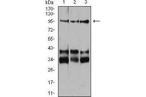 Western blot analysis using Neuropilin-1 mouse mAb against Jurkat (1), Hela (2), and HUVEC (3) cell lysate. (Neuropilin 1 antibody  (AA 45-59))