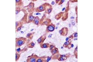 Immunohistochemistry (IHC) image for anti-Nuclear Receptor Subfamily 0, Group B, Member 2 (NR0B2) antibody (ABIN7308092) (NR0B2 antibody)