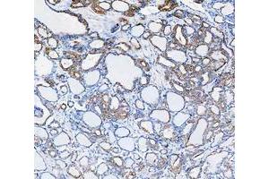 IHC analysis of Cytokeratin 8/KRT8 using anti-Cytokeratin 8/KRT8 antibody (ABIN5518853). (KRT8 antibody  (AA 107-325))