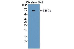 Western blot analysis of the recombinant protein. (TEK antibody  (AA 44-341))