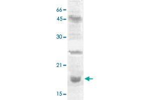 The nuclear extract derived from NIH/3T3 were immunoprecipitated by 4 ug of HIST2H3C polyclonal antibody , then probed with HIST2H3C polyclonal antibody  at 1 : 1000. (Histone Cluster 2, H3c (HIST2H3C) (Lys27) antibody)