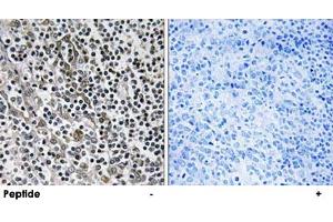 Immunohistochemistry analysis of paraffin-embedded human tonsil tissue using MRPL51 polyclonal antibody .