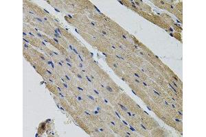 Immunohistochemistry of paraffin-embedded Rat heart using ALDH9A1 Polyclonal Antibody (ALDH9A1 antibody)