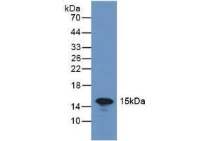 Detection of GAL7 in Rat Skin Tissue using Polyclonal Antibody to Galectin 7 (GAL7) (LGALS7 antibody  (AA 1-136))