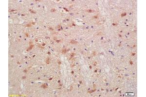 Formalin-fixed and paraffin embedded rat brain labeled with Anti-PMP2 Polyclonal Antibody, Unconjugated (ABIN676823) at 1:200, followed by conjugation to the secondary antibody and DAB staining