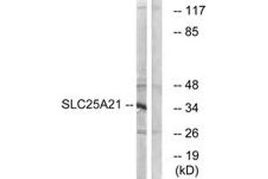Western Blotting (WB) image for anti-Solute Carrier Family 25 (Mitochondrial Oxodicarboxylate Carrier), Member 21 (Slc25a21) (AA 134-183) antibody (ABIN2879187)