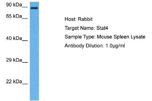 Host: Rabbit Target Name: STAT4 Sample Tissue: Mouse Spleen Antibody Dilution: 1ug/ml (STAT4 antibody  (N-Term))