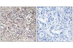 Immunohistochemistry analysis of paraffin-embedded human ovary tissue using CLDN6 antibody. (Claudin 6 antibody  (Internal Region))