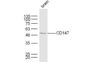 Mouse brain lysates probed with CD147 Polyclonal Antibody, unconjugated  at 1:300 overnight at 4°C followed by a conjugated secondary antibody at 1:10000 for 60 minutes at 37°C. (CD147 antibody  (AA 301-385))