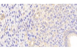 Immunohistochemistry (IHC) image for anti-Mucin 5 Subtype B (MUC5B) (AA 75-295) antibody (ABIN7429016)