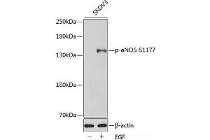 Western blot analysis of extracts of SKOV3 cells using Phospho-eNOS(S1177) Polyclonal Antibody. (ENOS antibody  (pSer1177))