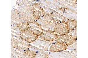 Immunohistochemistry analysis of paraffin-embedded rat muscle using,PPAPDC3 (ABIN7075036) at dilution of 1: 4000 (PPAPDC3 antibody)
