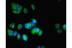 Immunofluorescent analysis of MCF-7 cells using ABIN7170753 at dilution of 1:100 and Alexa Fluor 488-congugated AffiniPure Goat Anti-Rabbit IgG(H+L) (CYP17A1 antibody  (AA 24-508))