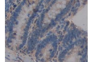 Detection of ICAM2 in Rat Small intestine Tissue using Polyclonal Antibody to Intercellular Adhesion Molecule 2 (ICAM2)