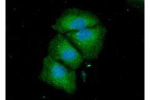 ICC/IF analysis of ACSF2 in HeLa cells line, stained with DAPI (Blue) for nucleus staining and monoclonal anti-human ACSF2 antibody (1:100) with goat anti-mouse IgG-Alexa fluor 488 conjugate (Green) (ACSF2 antibody)