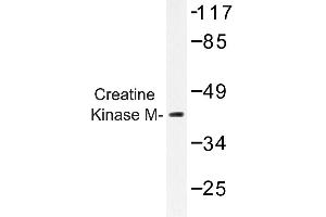 Image no. 1 for anti-Creatine Kinase, Muscle (CKM) antibody (ABIN272157) (CKM antibody)