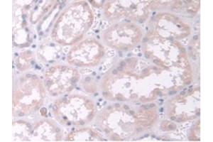 IHC-P analysis of Human Kidney Tissue, with DAB staining. (TPMT antibody  (AA 26-227))