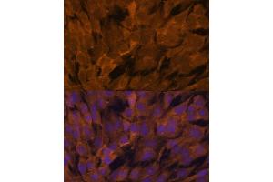 Immunofluorescence analysis of C6 cells using ST antibody (ABIN6129464, ABIN6148550, ABIN6148551 and ABIN6222848) at dilution of 1:100. (STAM2 antibody  (AA 376-525))