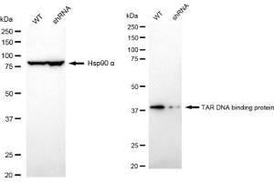 Western blotting analysis using TAR DNA binding protein antibody (ABIN7800512).