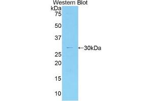 Western blot analysis of the recombinant protein. (MYO1G antibody  (AA 769-1016))