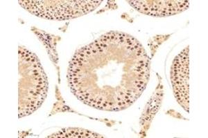 Immunohistochemistry analysis of paraffin-embedded mouse testis using,DAZAP1 (ABIN7073691) at dilution of 1: 6000 (DAZAP1 antibody)