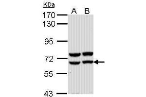 WB Image Sample (30 ug of whole cell lysate) A: Molt-4 , B: Raji 7. (AMY2A antibody)