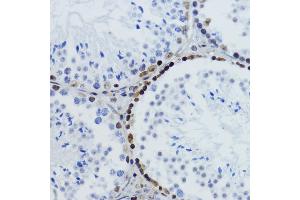 Immunohistochemistry (IHC) image for anti-Histone H2B (acLys12) antibody (ABIN7267731)