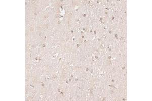 Immunohistochemistry of paraffin-embedded rat brain using HMGN1 antibody. (HMGN1 antibody)