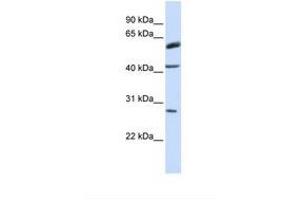 Image no. 1 for anti-Ring Finger Protein 170 (RNF170) (AA 110-159) antibody (ABIN6738072) (RNF170 antibody  (AA 110-159))