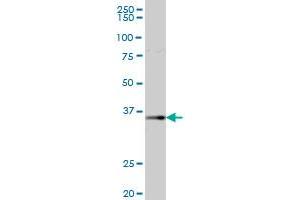 AKR1B1 MaxPab polyclonal antibody. (AKR1B1 antibody  (AA 1-316))