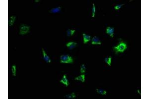 Immunofluorescence staining of SH-SY5Y cells with ABIN7158138 at 1:133, counter-stained with DAPI. (LRRC15 antibody  (AA 301-538))