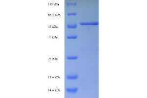 SDS-PAGE (SDS) image for Tumor Necrosis Factor Receptor Superfamily, Member 21 (TNFRSF21) (AA 371-655) protein (His-SUMO Tag) (ABIN5710524)