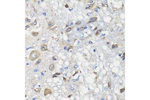 Immunohistochemistry of paraffin-embedded rat brain using BCS1L antibody. (BCS1L antibody  (AA 33-240))